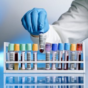 row of lab vials